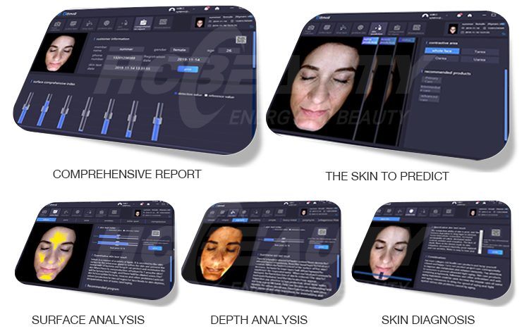 Most Popular in Europe Intelligent Professional Facial Problems Skin Analysis Device with I Pad