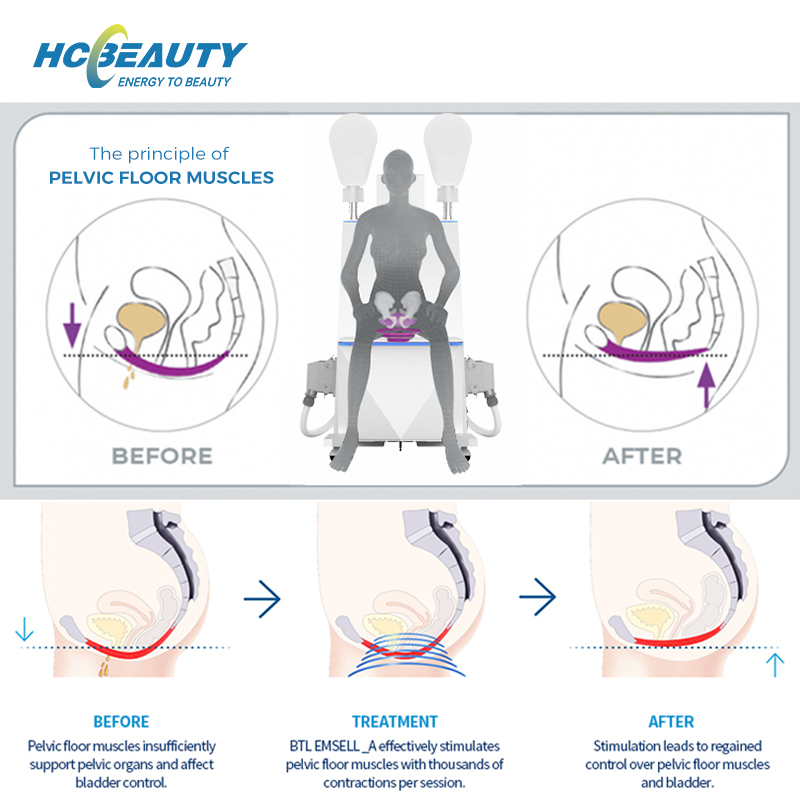 Body Conturing Noninvasive Fat Burning Ems Muscle Stimulation Hiemt Postpartum Repair Pelvic Floor Muscle Hcslim EMS14