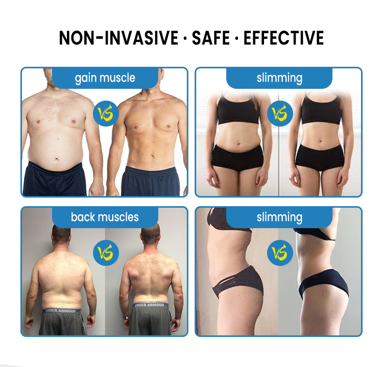 Emsculpt Machine for Sale Usa