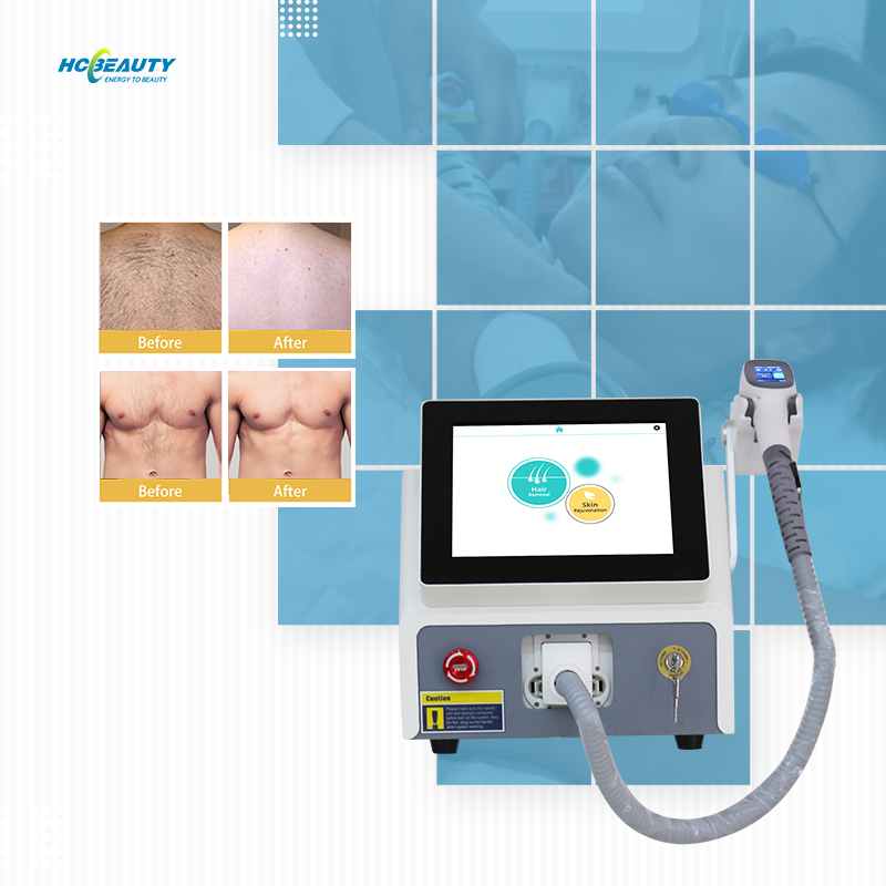 755nm 1064nm 808nm Laser Hair Removal Portable Machine
