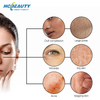 Oxygen Professional Beauty Machine Foam Massage Deep Cleaning Whitening Facial Treatment