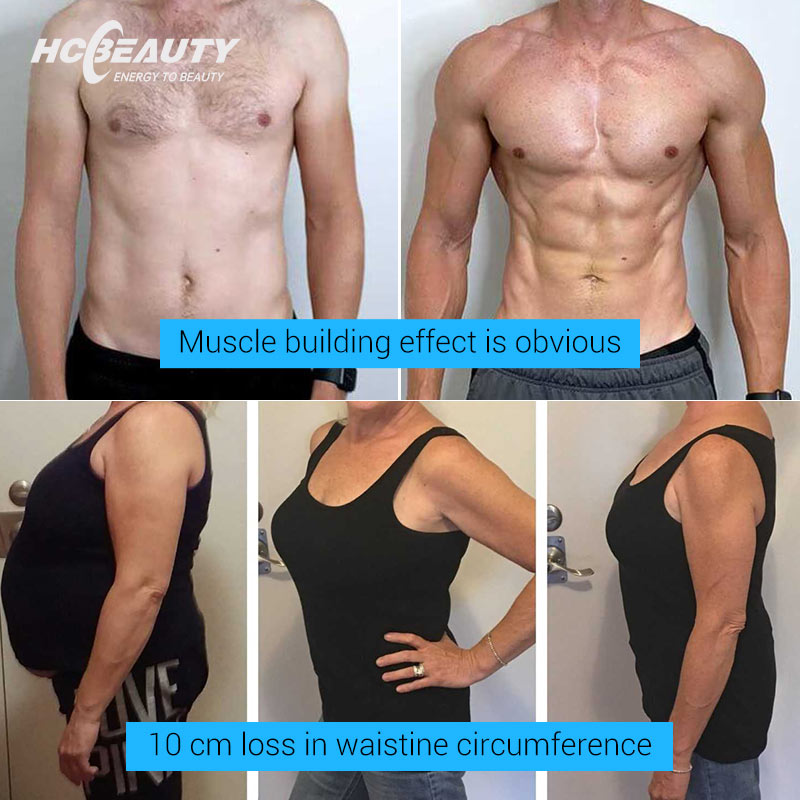 Emslim Em Sculpt Fat Burning Machine Teslasculpt