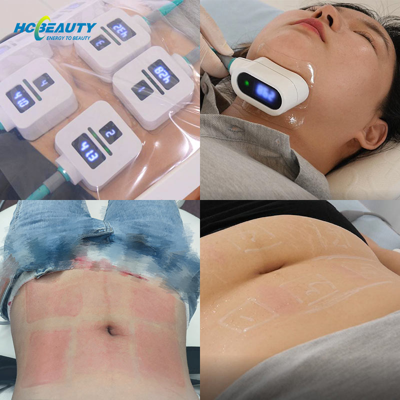 Portable 2 in 1 Body Sculpt Radio Frequency Machines for Estheticians