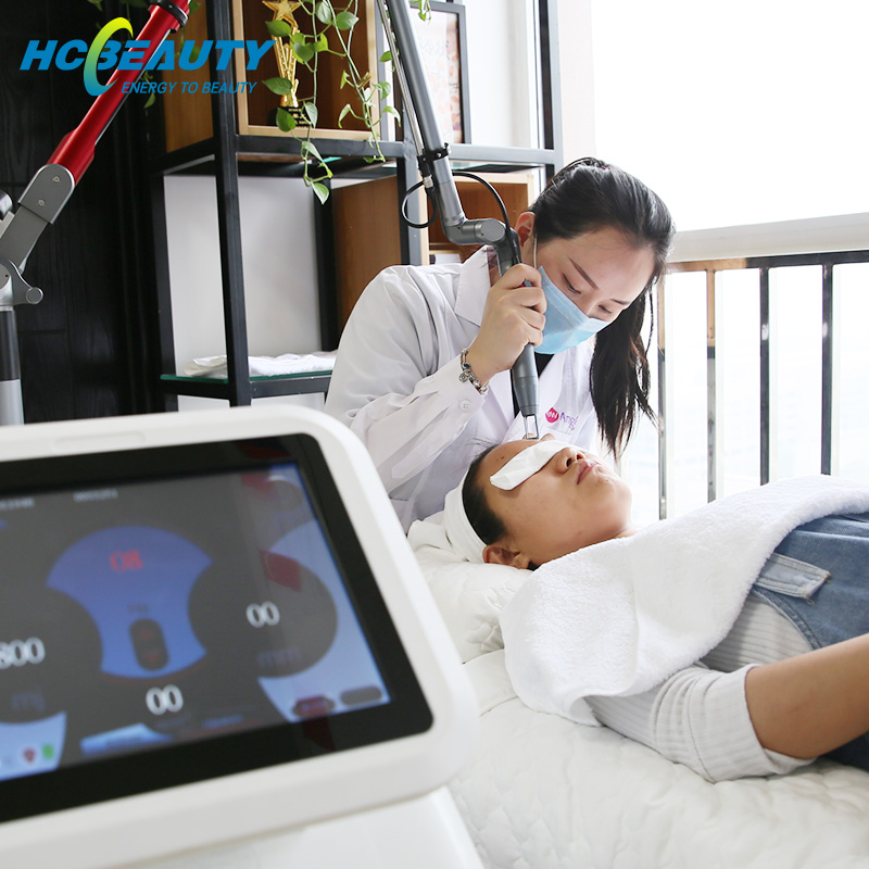 Permanent Treatment Effective Pico Laser Machine Cost