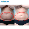 Non-surgical Safe Tech Body Slimming New Fat Freeze Machine